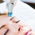 When is the Best Time to Get a HydraFacial?